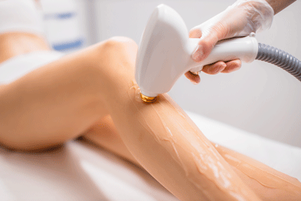 Laser Hair Removal