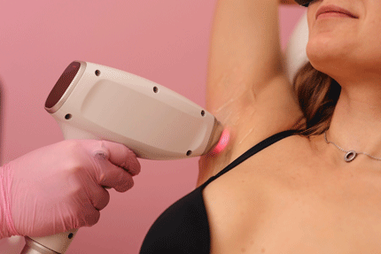 Laser Hair Removal