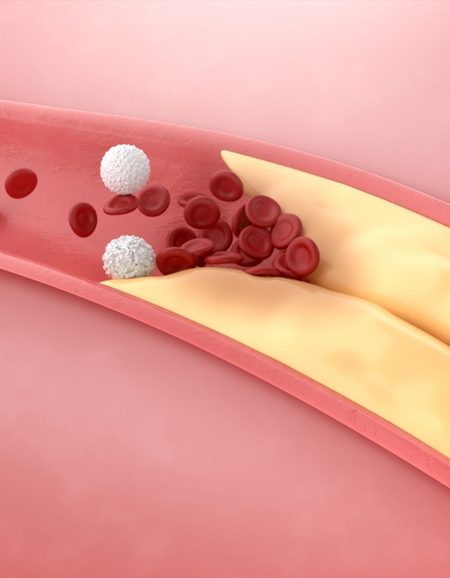 lipid panel test, cholesterol panel blood test