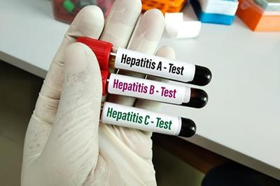 hepatitis panel test